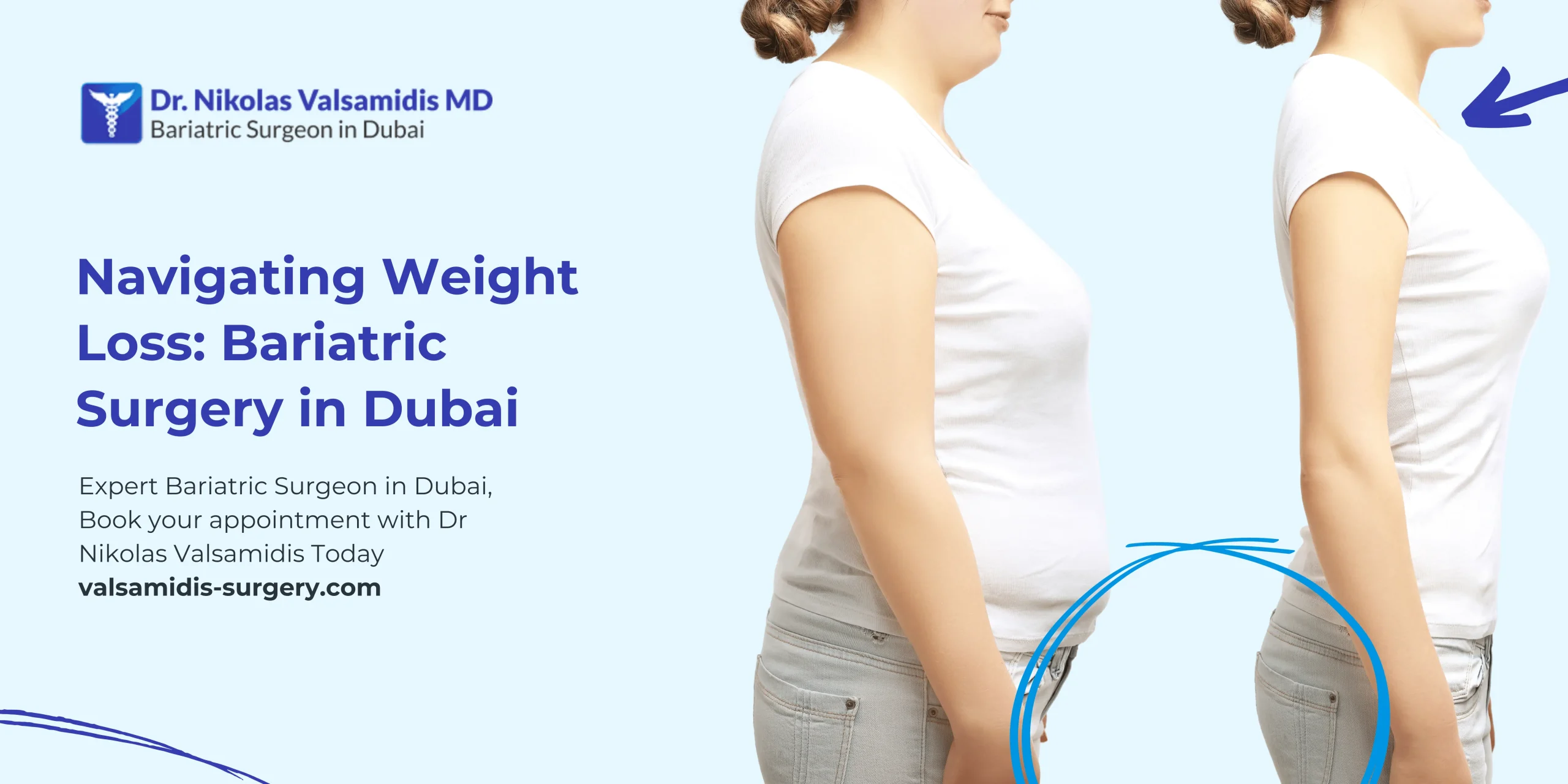Navigating Weight Loss: Bariatric Surgery in Dubai