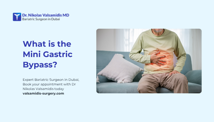 What is the Mini Gastric Bypass